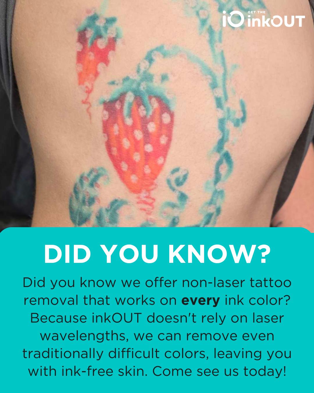 Did you know? Non-laser removal works on every ink color, including traditionally difficult ones.